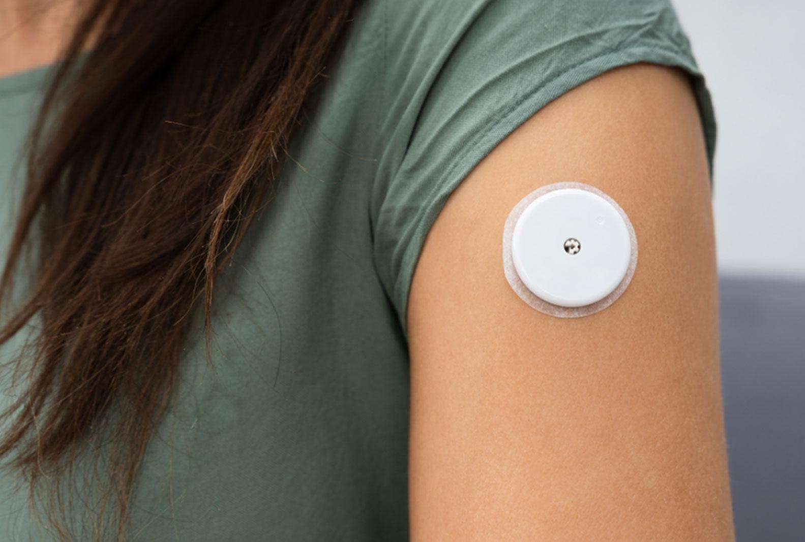 Continuous glucose monitor sensor worn on the upper arm